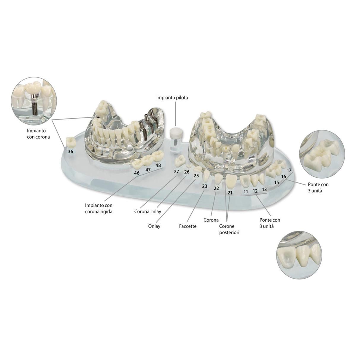 MODELLO STUDIO IMPLANT C+B - 1 pz.